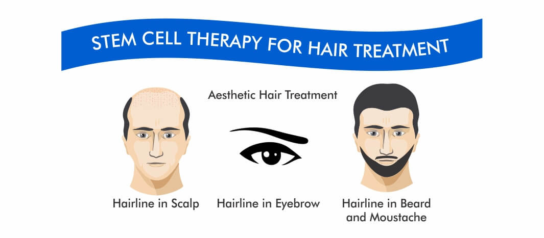 Regain Hair Clinic Stem Cell Therapy Regain Hair Clinic Stem Cell Therapy